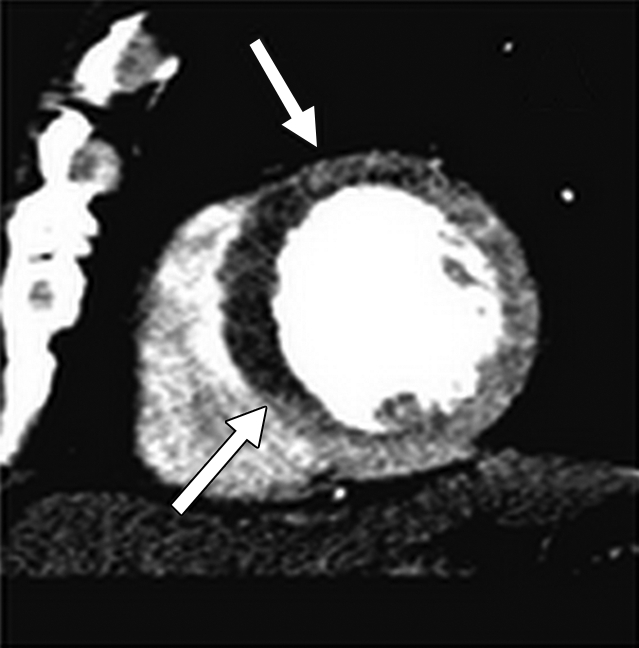 Figure 1a: