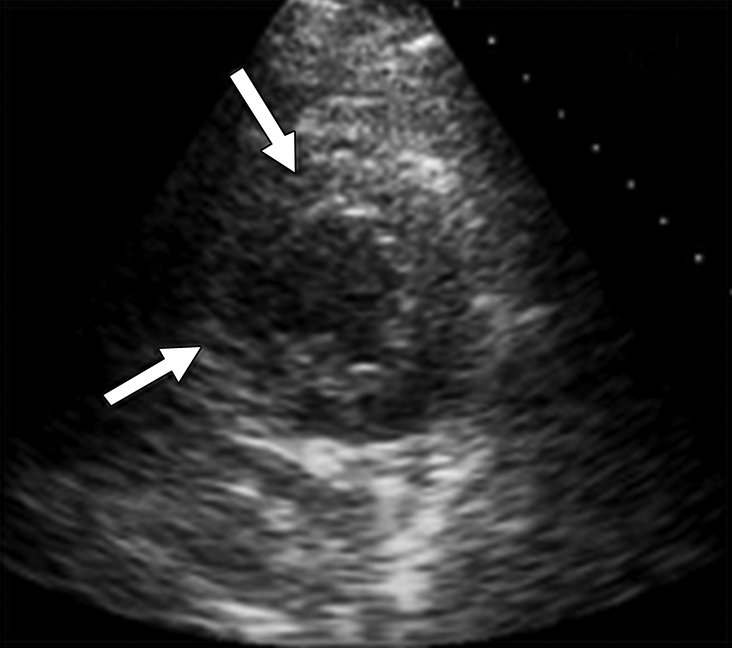 Figure 1c: