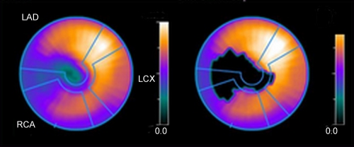 Figure 1d: