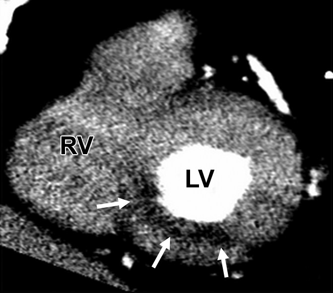 Figure 5b: