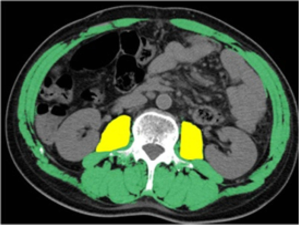 Fig. 2