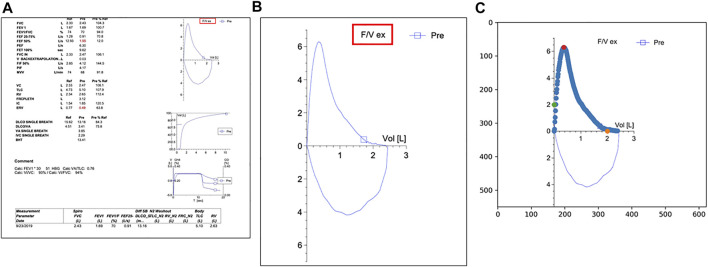 FIGURE 1