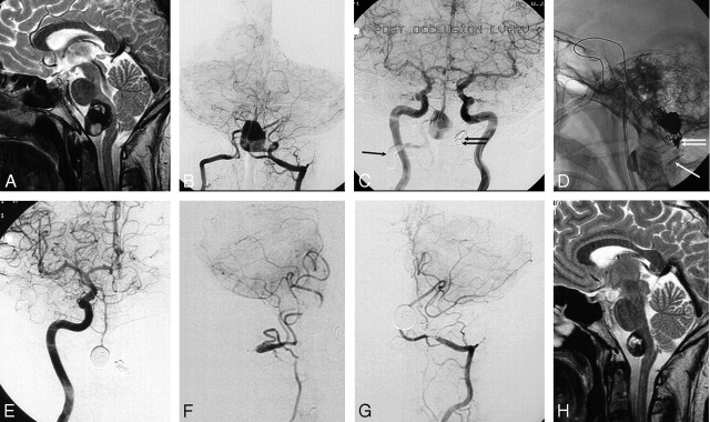 Fig 3.