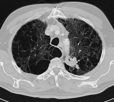 graphic file with name 978-3-642-33108-4_2_Fig20_HTML.jpg