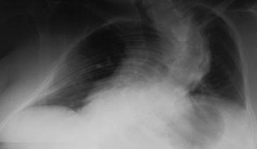 graphic file with name 978-3-642-33108-4_2_Fig12_HTML.jpg