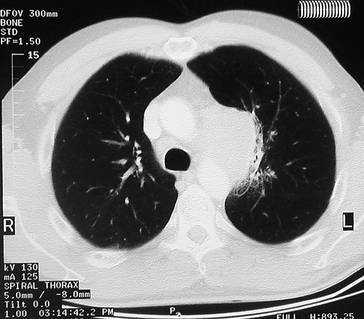 graphic file with name 978-3-642-33108-4_2_Fig28_HTML.jpg