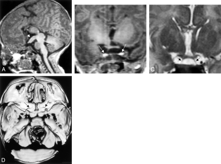 Fig 2.