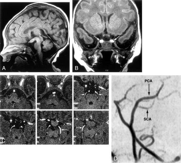 Fig 5.