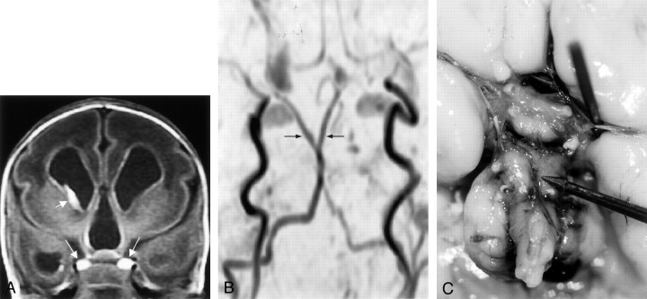 Fig 4.