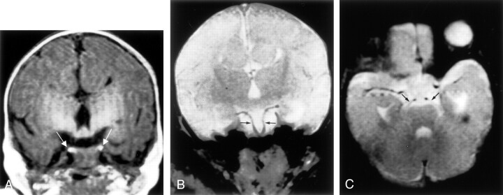 Fig 3.