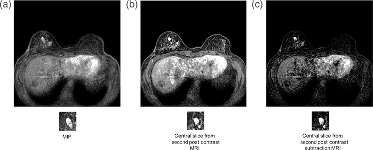 Fig. 9.