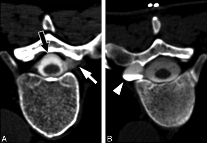 Fig 5.