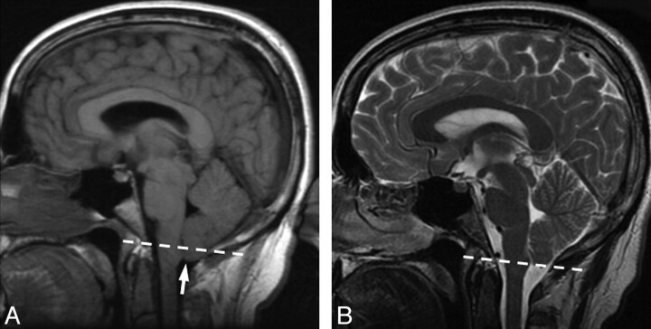 Fig 3.