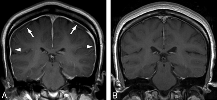 Fig 2.