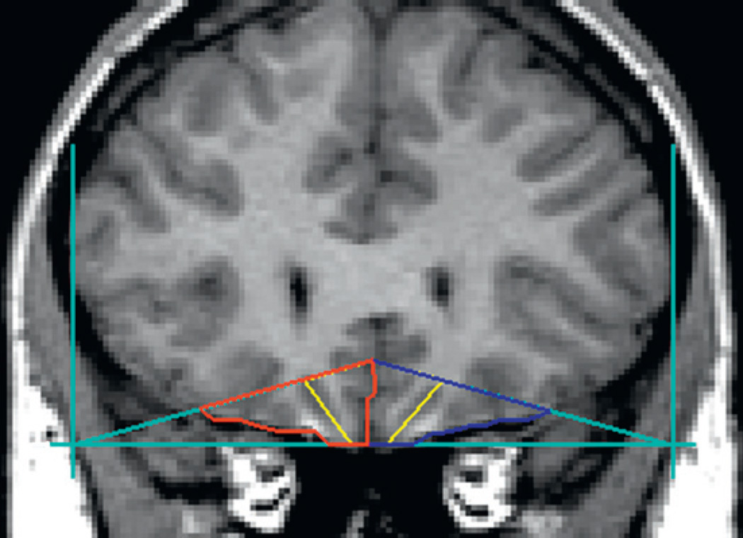 Fig. 10