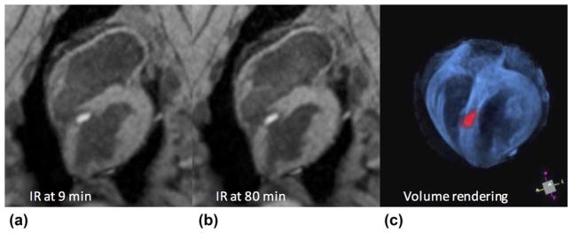 FIG. 3