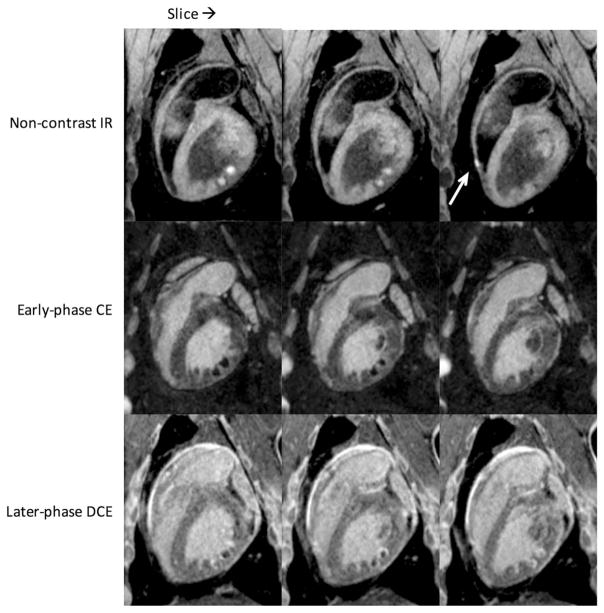 FIG. 5