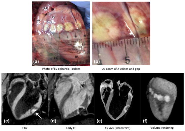 FIG. 6