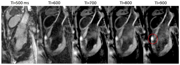 FIG. 4