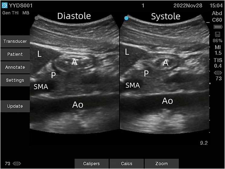 Fig. 2