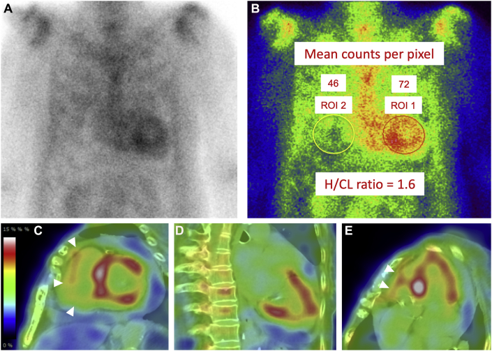 Figure 3