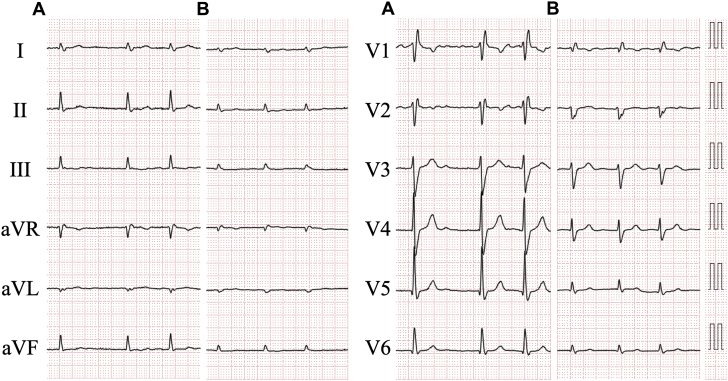 Figure 1