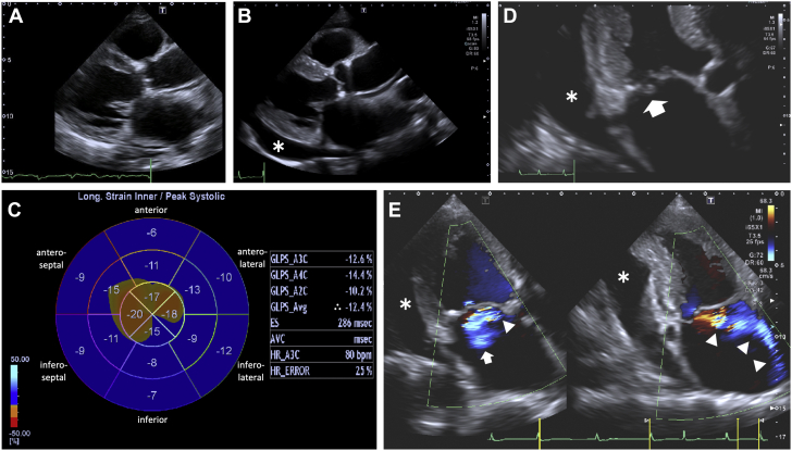 Figure 2