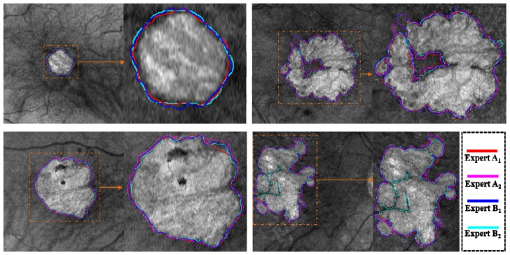 Fig. 11