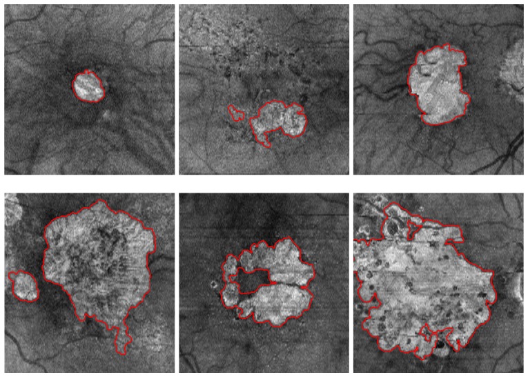 Fig. 10