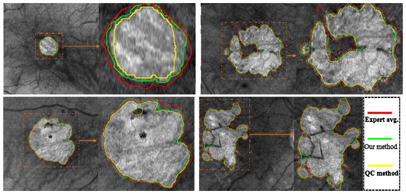 Fig. 12