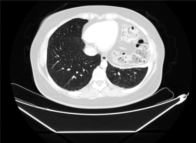 Fig. 1C