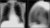 Figure 38