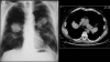 Figure 25