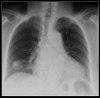 Figure 22