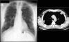 Figure 33