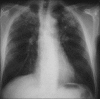 Figure 30
