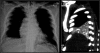 Figure 35