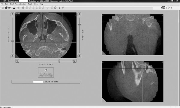 Figure 16