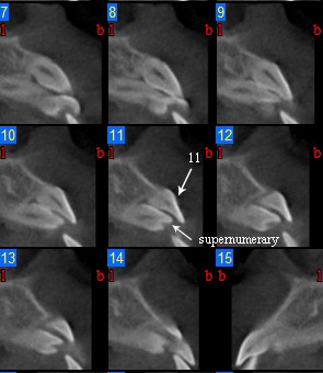 Figure 15