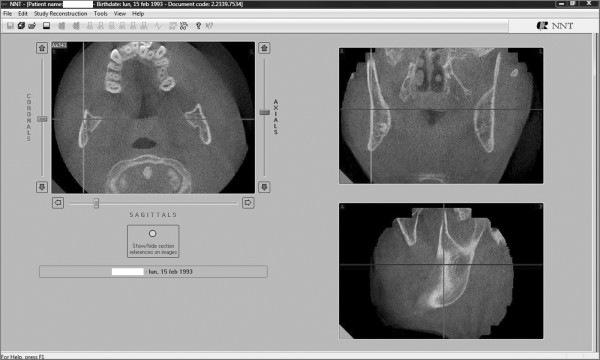 Figure 17