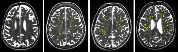 Fig. 6