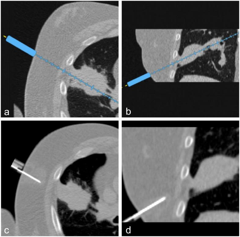 Fig 6