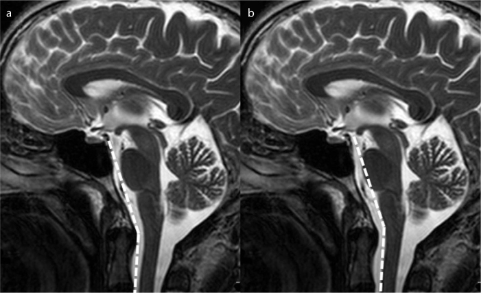 Figure 1. a, b.