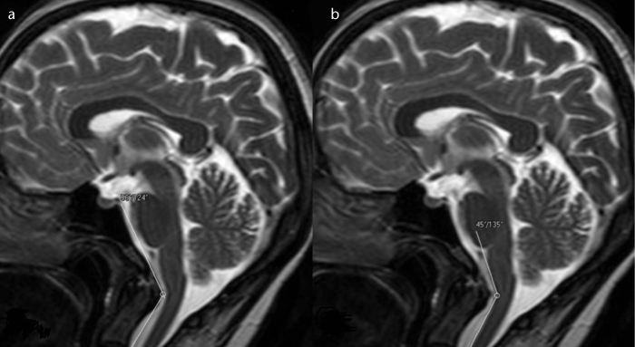 Figure 4. a, b.