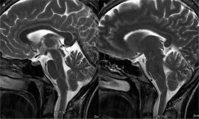 Figure 3. a, b.