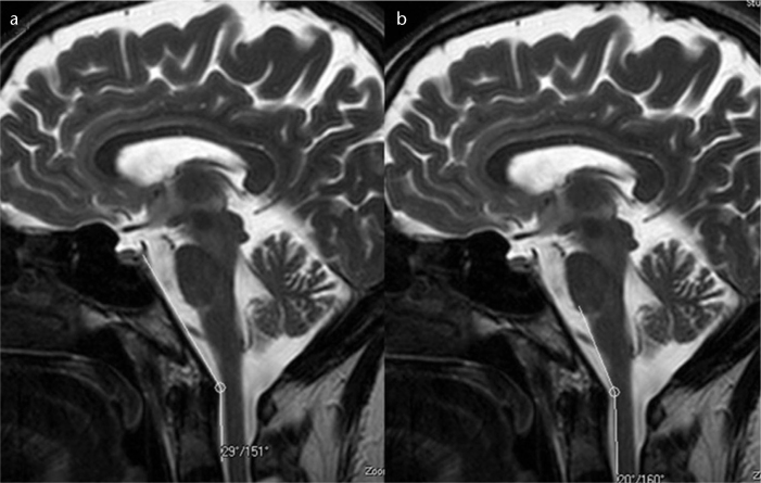 Figure 2. a, b.