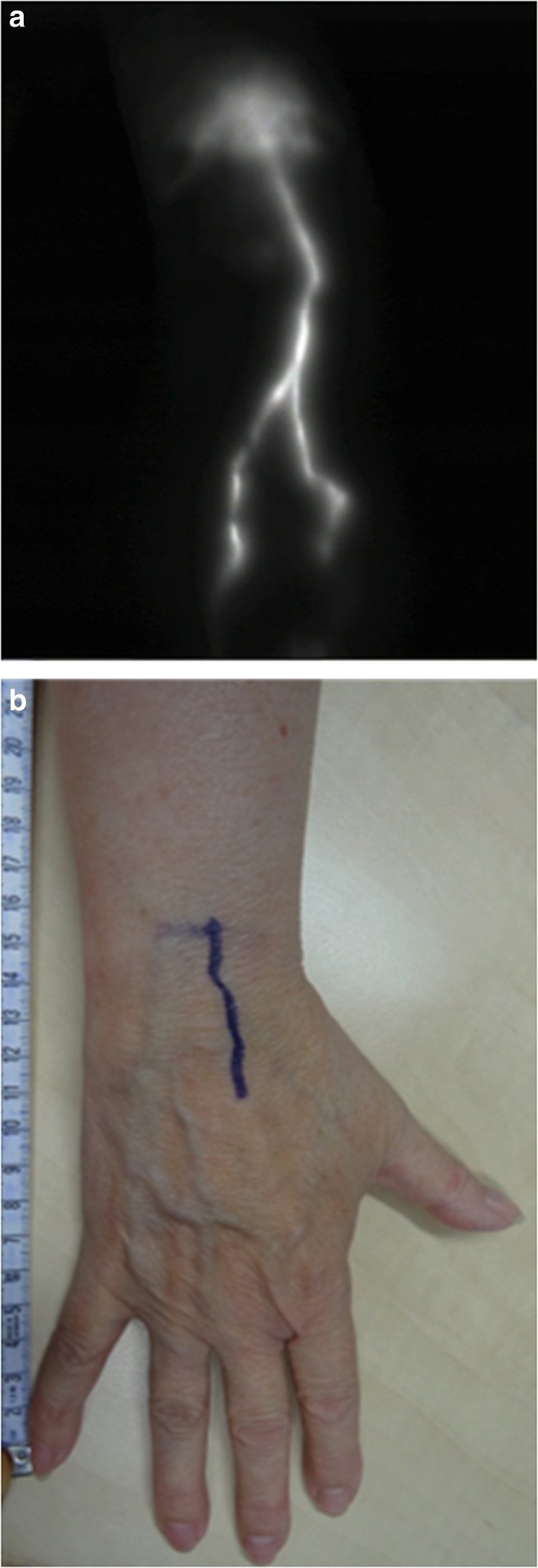 Fig. 3