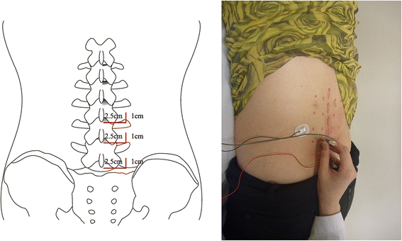 Fig. 1