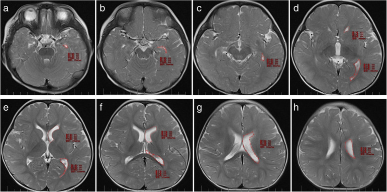 Fig. 2