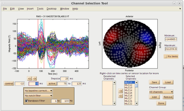 FIGURE 4